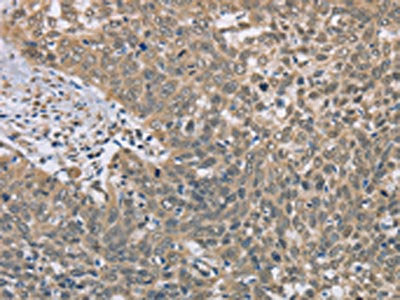 DACH2 Antibody