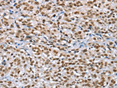 MCM6 Antibody