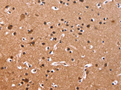 CSNK1D Antibody