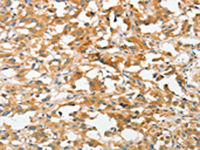 UCHL5 Antibody