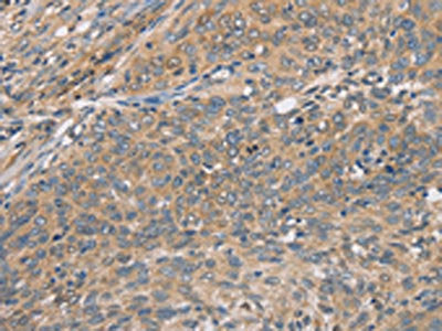 CST2 Antibody