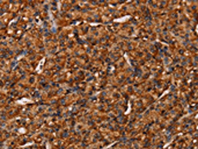 COL18A1 Antibody