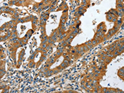 COL1A2 Antibody