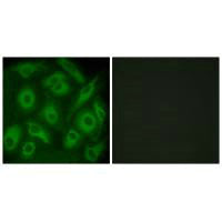 CDH23 Antibody