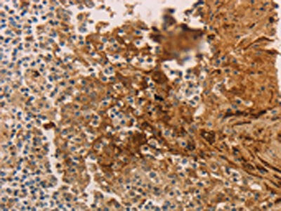 ADCYAP1R1 Antibody