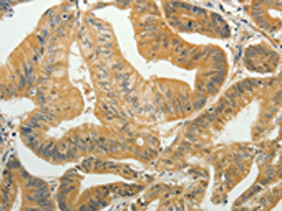 TAGLN2 Antibody