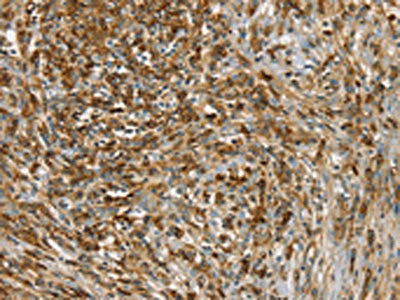 SIK1 Antibody