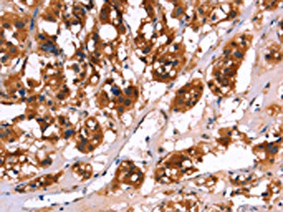 CALB1 Antibody