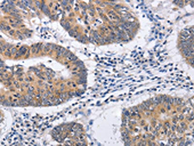 RCHY1 Antibody