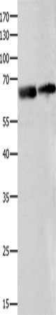 IGF2BP2 Antibody