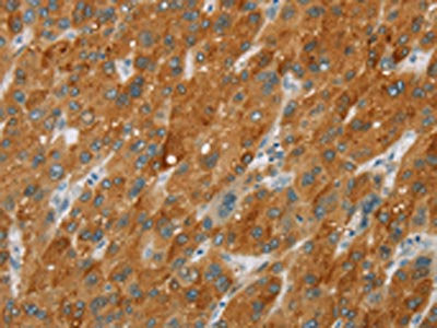 CYP2E1 Antibody