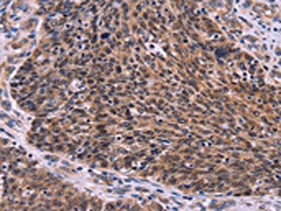 CDC5L Antibody