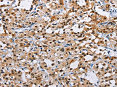 ATXN1 Antibody