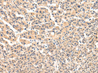 VPS33B Antibody