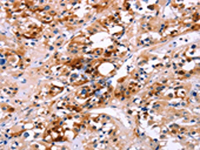 CALB1 Antibody