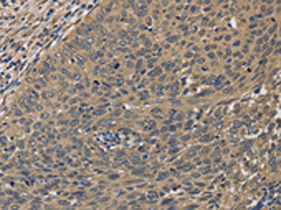 HSF1 Antibody
