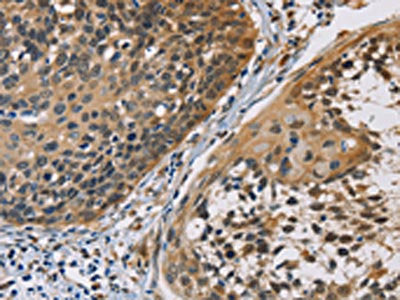 CBR1 Antibody