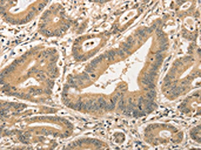 CDCA8 Antibody