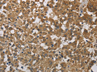 CYB5A Antibody