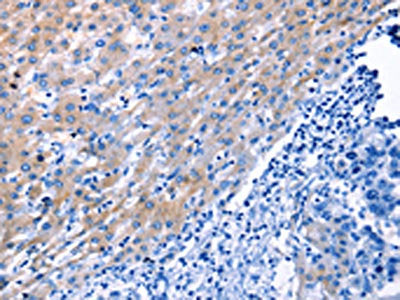 LAMA3 Antibody