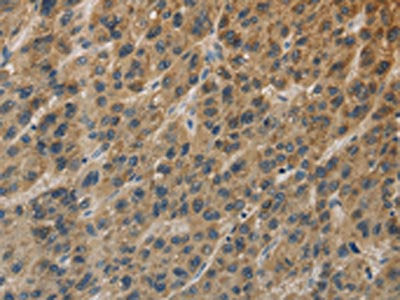 TBXAS1 Antibody