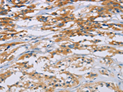 CD33 Antibody