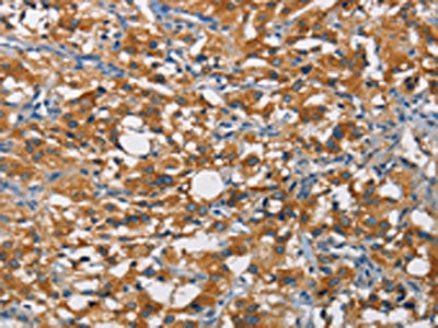 CRTAM Antibody