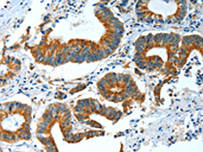 BAG3 Antibody