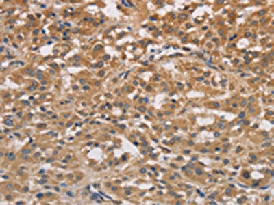 DSTN Antibody