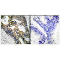MMP7 Antibody