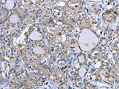 FCAR Antibody