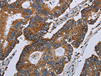 MT-ND3 Antibody