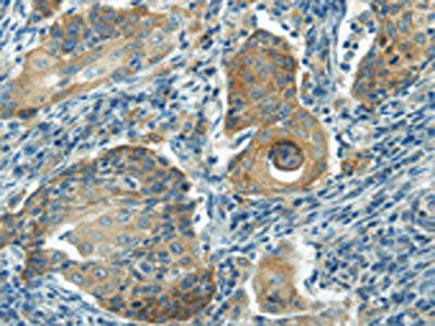 IL20 Antibody