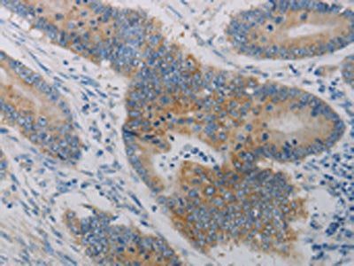 CLEC4C Antibody