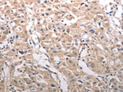 RAD52 Antibody