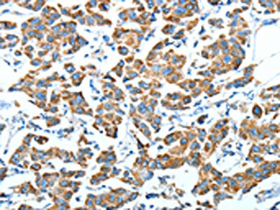 ALDH6A1 Antibody