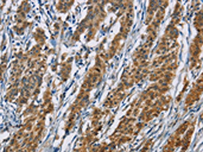 ACVR1 Antibody