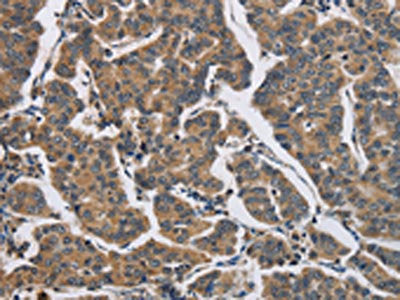 DHRS3 Antibody