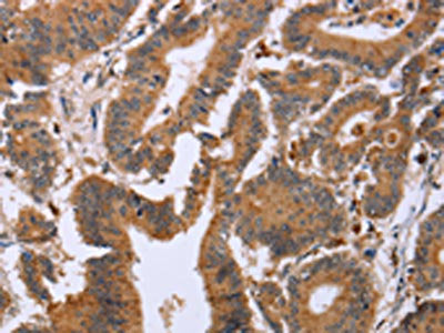 EPDR1 Antibody