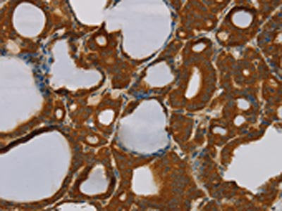 PARP3 Antibody