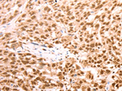 AMD1 Antibody
