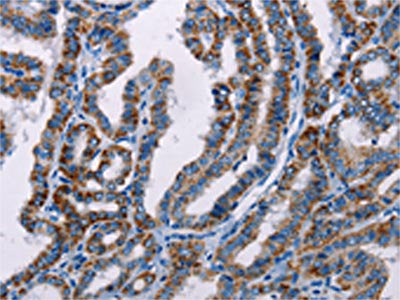 FHIT Antibody