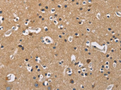 GNB5 Antibody