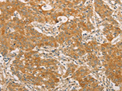 SNAP91 Antibody