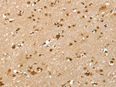 SLTM Antibody
