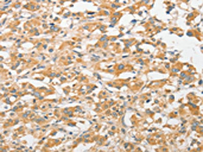 TLR5 Antibody