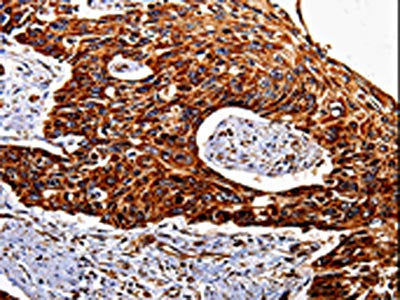 IL17RC Antibody