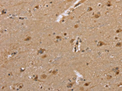 DLD Antibody