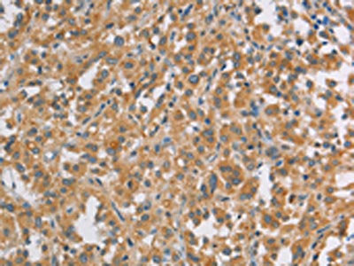 DDX53 Antibody