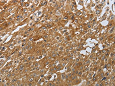 PTPRM Antibody